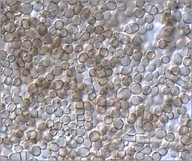 Spores of Cladosporium on a tape sample