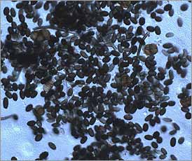 Microscopic view of Stachybotrys and a few Ulocladium spores